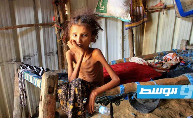 «فاو» تسعى لجمع 50 مليون دولار لمواجهة انعدام الأمن الغذائي باليمن