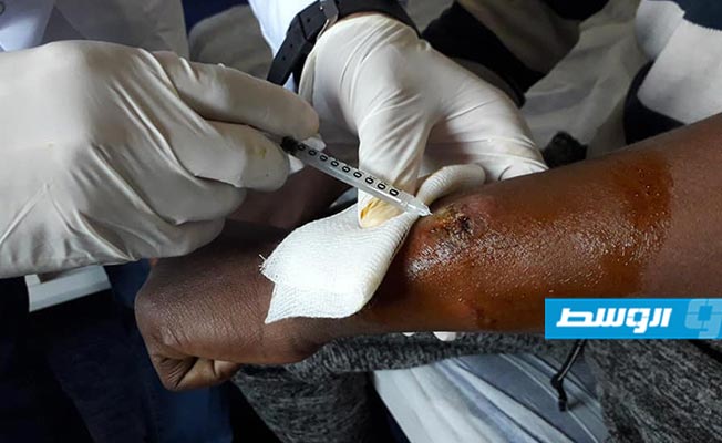 «مكافحة الأمراض» يسجل 429 إصابة باللمشانيا خلال أسبوع