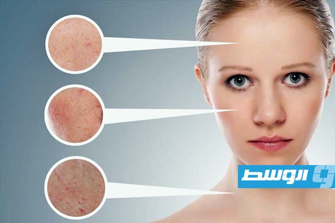 النشا وماء الورد لتوحيد لون البشرة