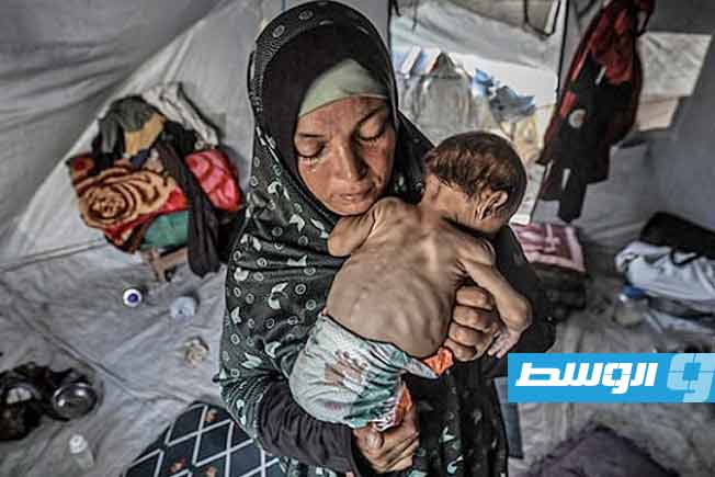 5 وفيات بينهم طفل بسبب المجاعة وسوء التغذية في غزة خلال 24 ساعة