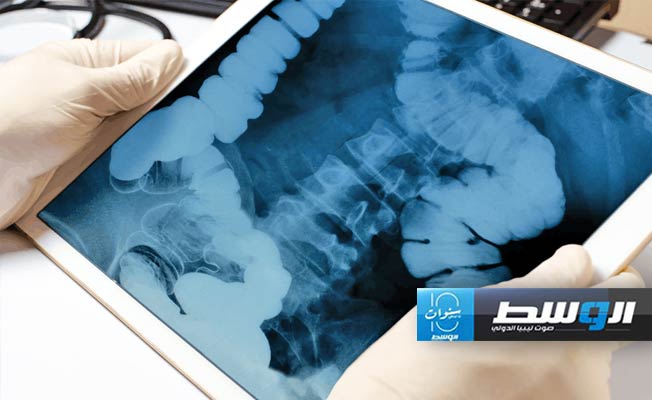 التوتر المزمن يسرع نمو الأورام السرطانية.. دراسة صينية تكشف الأسباب