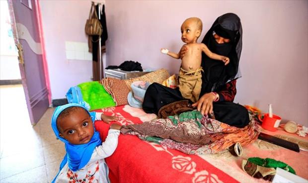 الـ«يونيسف»: طفل بين كل ثلاثة عالميا يعاني سوء التغذية