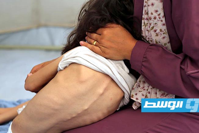 الأمم المتحدة: شخص من كل 11 نسمة يعاني من الجوع حول العالم