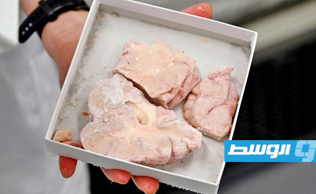 عقول في المخازن.. سر احتفاظ جامعة دنماركية بأدمغة أكثر من 9 آلاف مريض نفسي