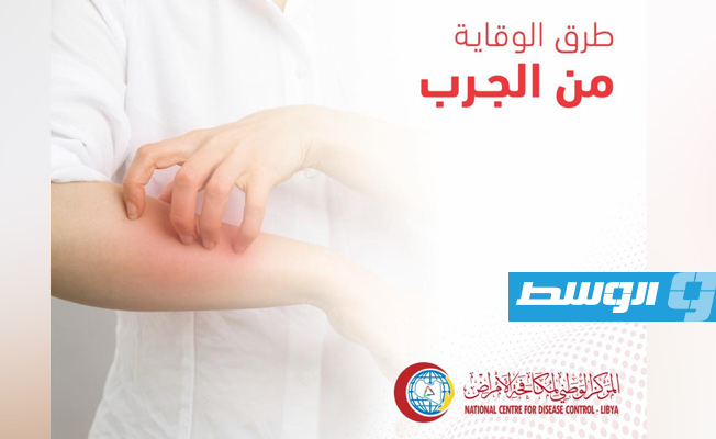 بالصور: «الوطني لمكافحة الأمراض» يكشف طرق الوقاية من الجرب