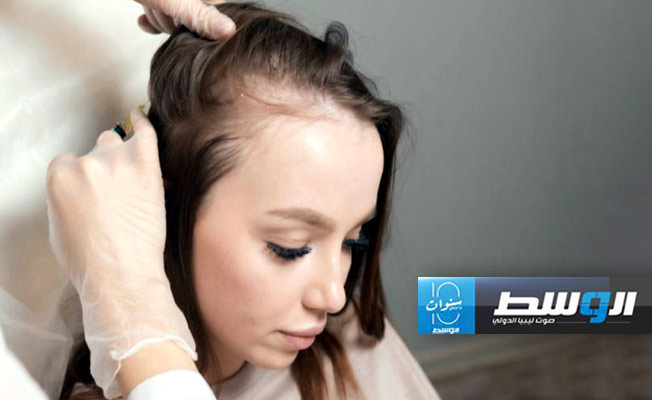 وصفات طبيعية تحميك من «الصلع»