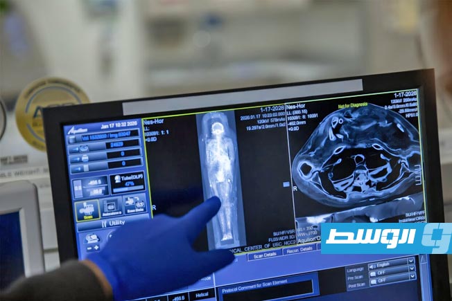 مسح ثلاثي الأبعاد لكهنة من العهد الفرعوني يكشف أمراض العصر قبل 2200 عام