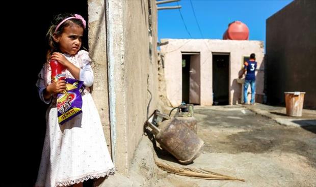 شامة عملاقة تحول حياة طفلة إلى مأساة