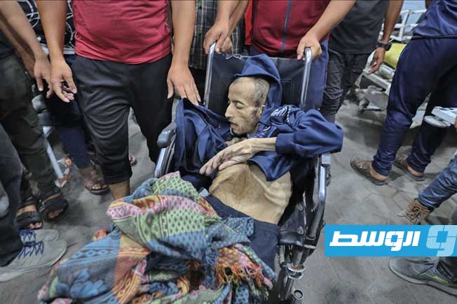 «الصحة الفلسطينية»: ارتفاع عدد ضحايا المجاعة في غزة إلى 101 شهيد بينهم 80 طفلا