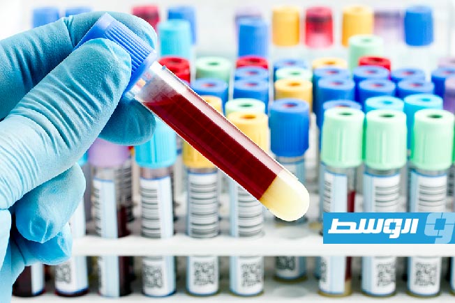 اختبار بسيط للدم يكشف الإصابة المبكرة بسرطان المبيض