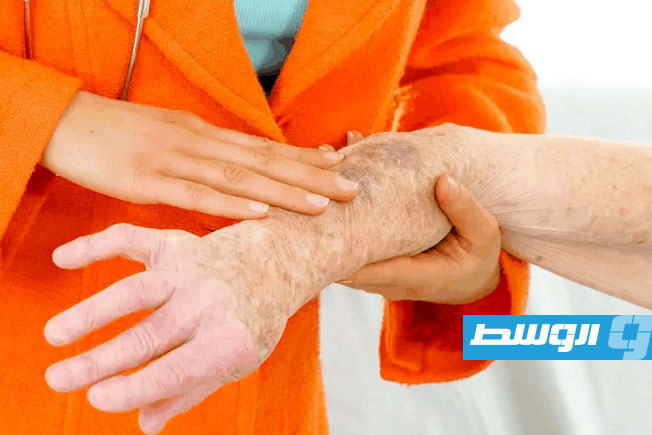 باحثون يكشفون إمكان استخدام «خلايا زومبي» في علاج السرطان