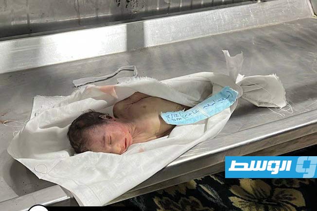 في غزة.. «يقولون إن الحرب انتهت.. لكن الناس ما زالوا يكافحون للنجاة»