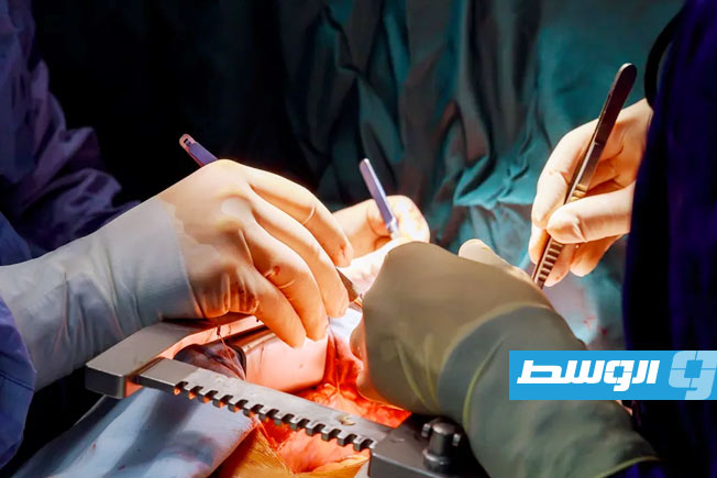 إنجاز طبي تاريخي بإجراء أول عملية «قلب» عبر ساق المريض
