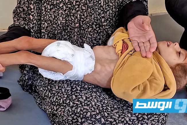 استشهاد 8 فلسطينيين بينهم طفلان بسبب سوء التغذية
