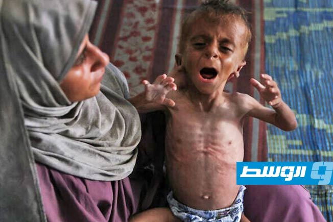 «الصحة الفلسطينية»: ارتفاع ضحايا المجاعة في غزة إلى 367 شهيدًا