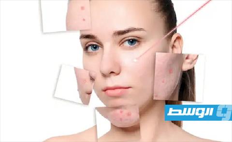 الزنجبيل وزيت اللوز للتخلص من البثور