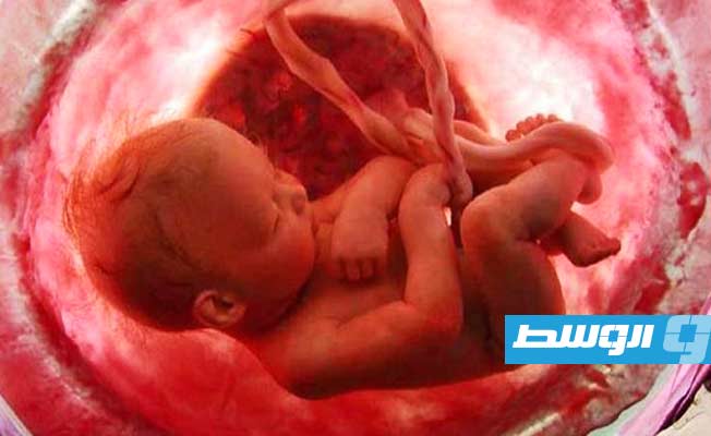 علاج جنين من اضطراب نادر مميت قبل الولادة