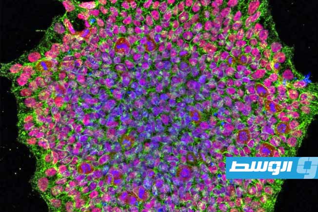 الخلايا الجذعية قادرة على إعادة تنشيط إنتاج الأنسولين لدى مرضى السكري من النوع الأول