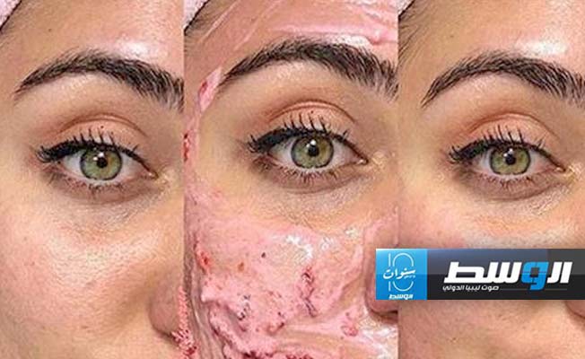 قناع منزلي للعناية بالبشرة الدهنية