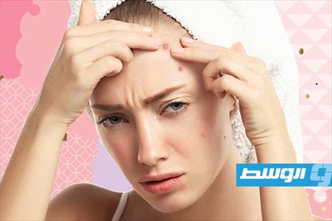 محلول منزلي من مكونات طبيعية للتخلّص من البثور