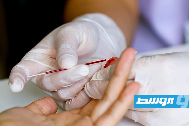 اختبار منزلي بسيط يساعد في الكشف المبكر عن الإصابة بألزهايمر