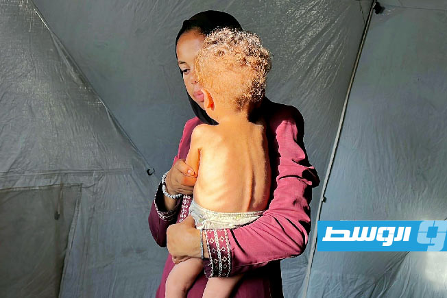 «الصحة الفلسطينية»: 5 حالات وفاة جديدة بسبب استمرار المجاعة في غزة