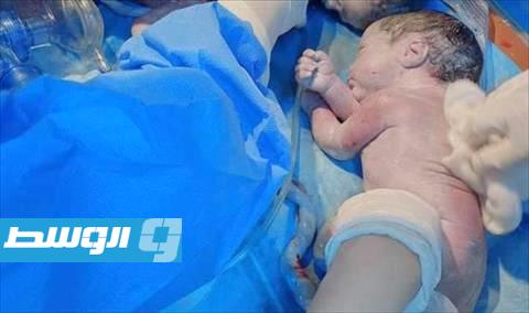 إجراء عملية طارئة لأم حامل بثلاثة توائم في مستشفى المرج