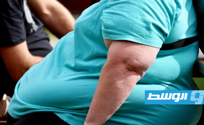 نصف البشر سيعاني من السمنة بحلول 2035