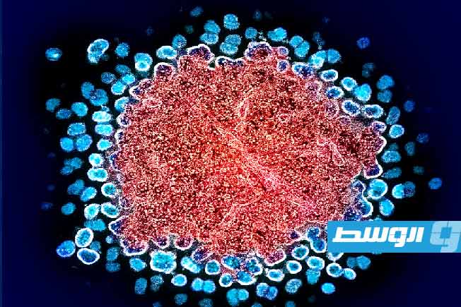 خامس حالة شفاء عالمية من فيروس نقص المناعة البشرية بفضل طفرة وراثية نادرة