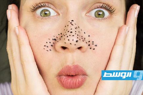 بيكربونات الصوديوم للتخلص من بثور الأنف