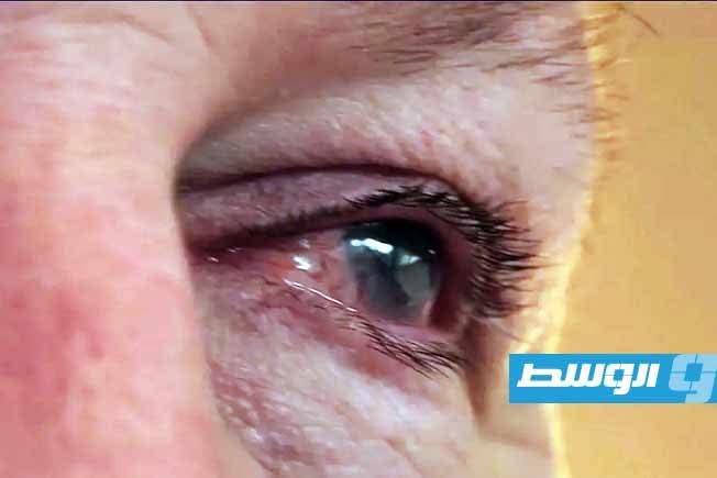 فيديو.. رقعة مشيمية تعيد الأمل لرجل فقد بصره جزئيًا