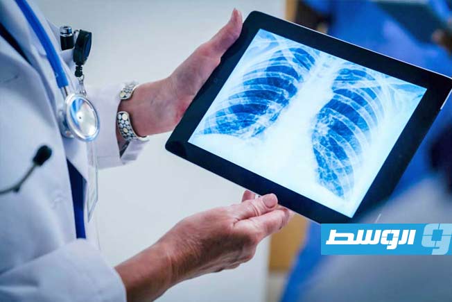 الحمية الغذائية الغنية بالبوتاسيوم تقلل خطر الإصابة بأمراض القلب بنسبة 24%