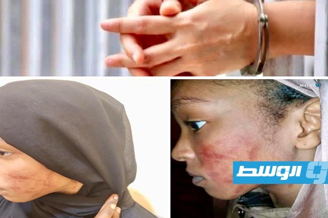 ضبط معلم اعتدى بالضرب المبرح على طالبة في أوباري