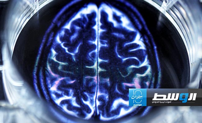 دراسة تكتشف شبكة دماغية أكبر بمرتين في حالات الاكتئاب