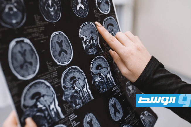 التوتر المزمن يرفع خطر الإصابة بالسكتة الدماغية لدى السيدات