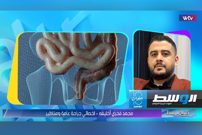 شاهد في «صباح الوسط»: التصاق الأمعاء.. أسبابه وأعراضه وطرق العلاج