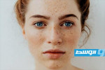 تخلصي من النمش بمكونات طبيعية من مطبخك