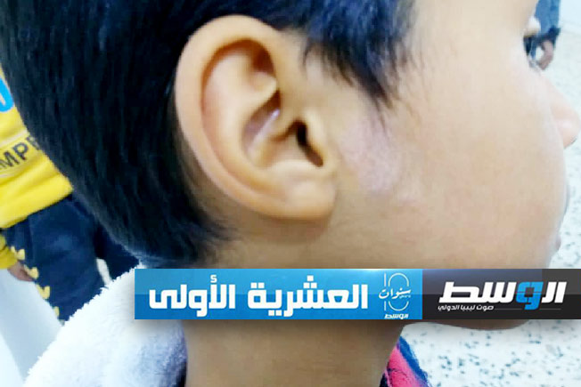 «الصحة» تعلن افتتاح عيادات جلدية في بئر الغنم