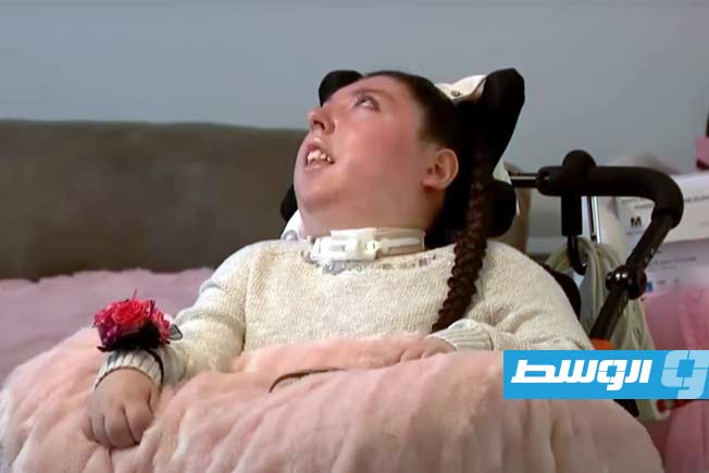معجزة طبية: فتاة مولودة بعيب خلقي شديد الندرة تحتفل بميلادها العشرين (فيديو)